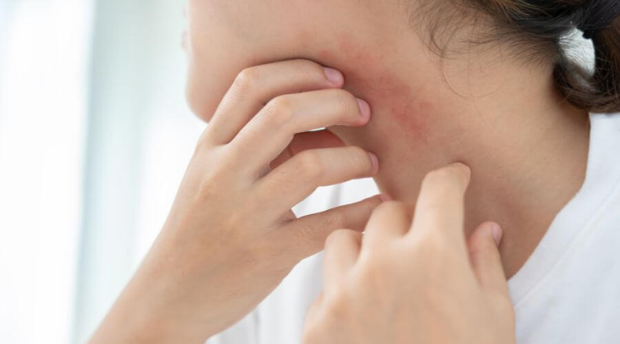 Meine Haut juckt ständig – welche Pflege hilft mir?